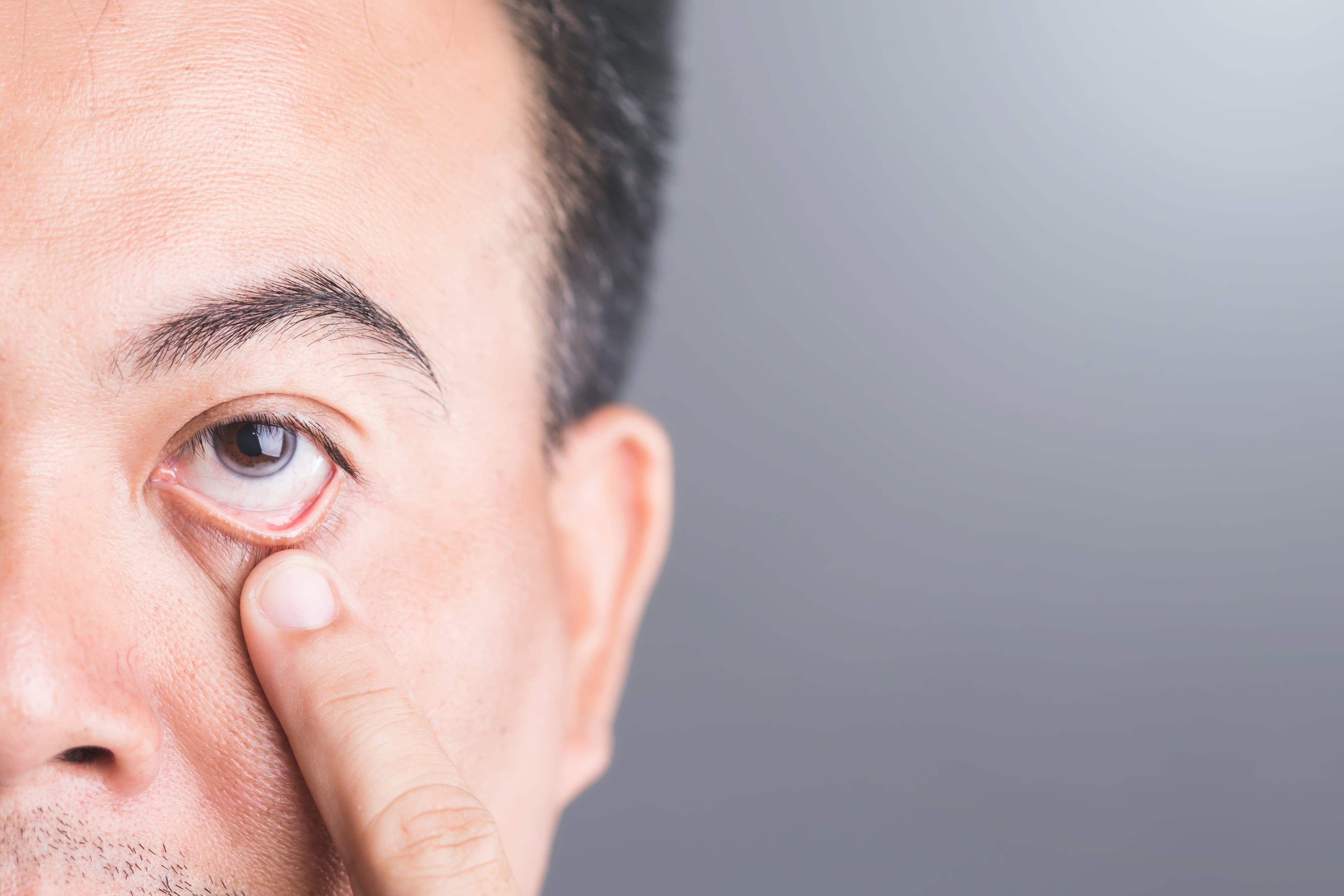 Diabetična retinopatija