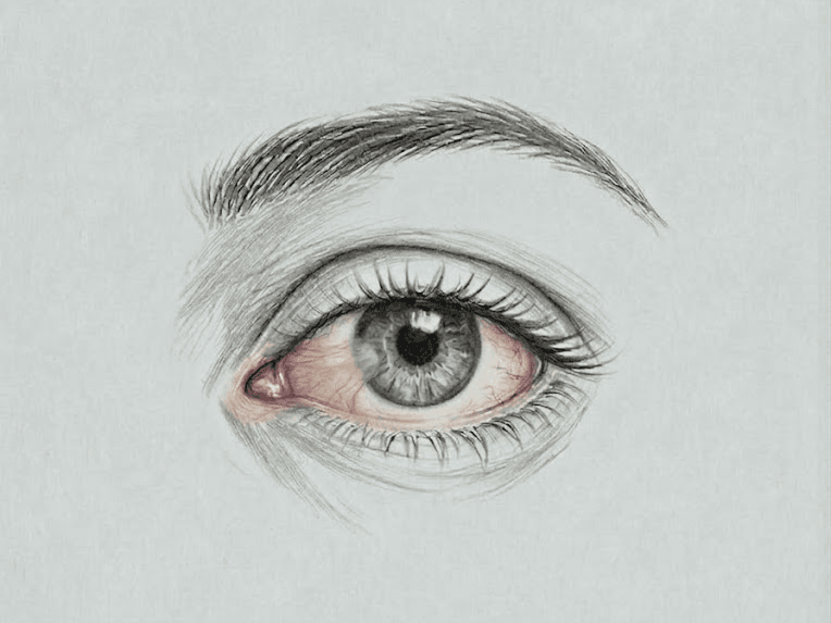 Mali očesni posegi - Pterigij