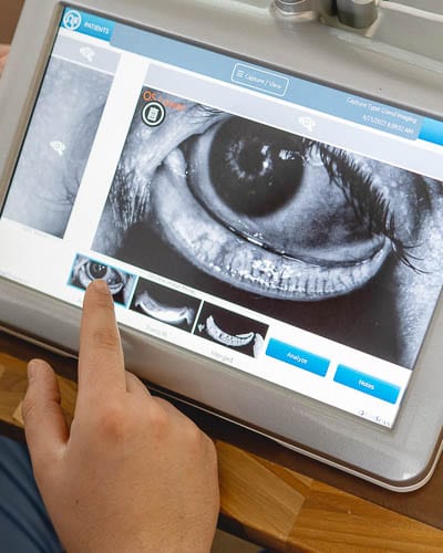 Fotografija nega vek