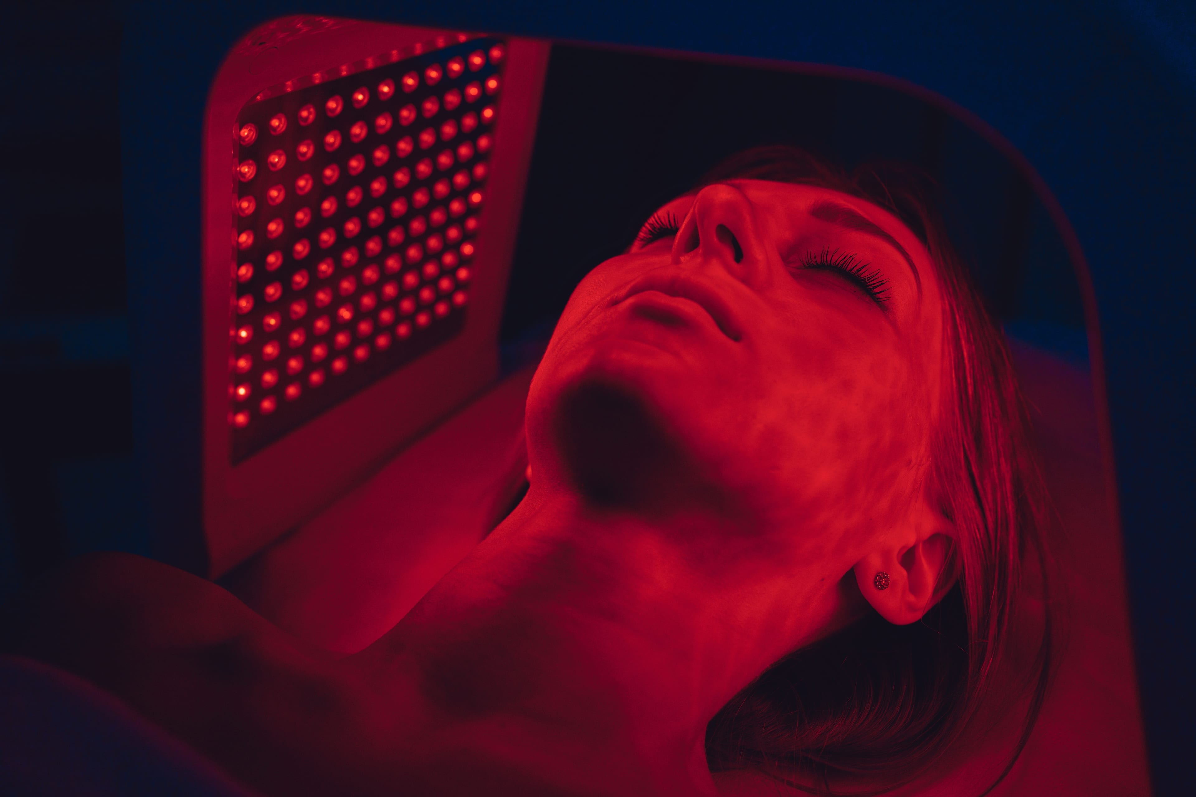 Fotobiomodulacija